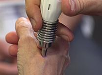 LaserPen acupuncture